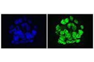 GLIS1 antibody (mAb) tested by Immunofluorescence. (GLIS1 抗体)