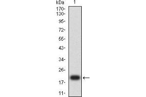 Western blot analysis using MDM2 mAb against human MDM2 (AA: 26-169) recombinant protein.