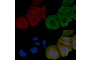 ABIN6258384 and ABIN6274981 staining Hela cells by IF/ICC. (CDC42EP4 抗体  (Internal Region))