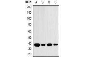 Western blot analysis of IDH3 alpha expression in MCF7 (A), HT29 (B), mouse brain (C), mouse kidney (D) whole cell lysates. (IDH3A 抗体)
