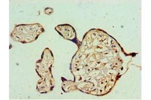 Immunohistochemistry (IHC) image for anti-Far Upstream Element (FUSE) Binding Protein 3 (FUBP3) (AA 65-260) antibody (ABIN7152570)