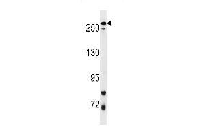 Park8 (LRRK2) Antibody  f western blot analysis in mouse lung tissue lysates (35 μg/lane). (LRRK2 抗体  (AA 878-909))
