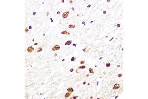Immunohistochemistry of paraffin-embedded rat brain using SRSF1/SRSF1/SF2/ASF Rabbit mAb (ABIN7270213) at dilution of 1:100 (40x lens). (SRSF1 抗体)