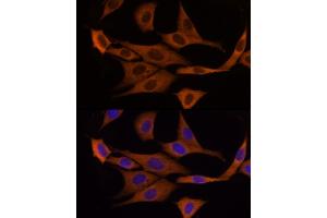 Immunofluorescence analysis of NIH/3T3 cells using GSDMD Rabbit pAb  at dilution of 1:200 (40x lens). (GSDMD 抗体)
