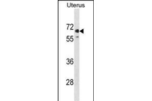 EL1 Antibody (N-term) (ABIN1881545 and ABIN2839006) western blot analysis in human Uterus tissue lysates (35 μg/lane). (MMEL1 抗体  (N-Term))