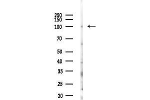 anti-Origin Recognition Complex, Subunit 1 (ORC1L) (Internal Region) antibody