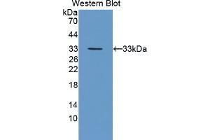 Western blot analysis of the recombinant protein. (FES 抗体  (AA 510-770))