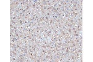 Immunohistochemistry of paraffin-embedded Rat liver using SNW1 Polyclonal Antibody at dilution of 1:100 (40x lens). (SNW1 抗体)