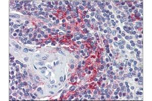 Human Spleen (formalin-fixed, paraffin-embedded) stained with VAV3at 5 µg/ml followed by biotinylated anti-goat IgG secondary antibody, alkaline phosphatase-streptavidin and chromogen. (VAV3 抗体  (Internal Region))