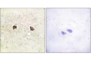 Immunohistochemistry analysis of paraffin-embedded human brain tissue, using EPHB1/2 (Ab-594/604) Antibody. (EPHB1/2 抗体  (AA 561-610))