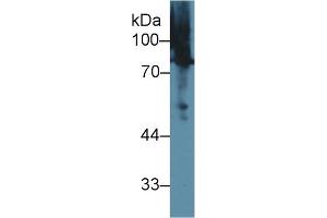 Western Blotting (WB) image for anti-Moesin (MSN) (AA 353-577) antibody (ABIN1859887)