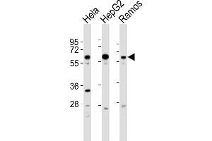 All lanes : Anti-GRK5 Antibody  at 1:2000 dilution Lane 1: Hela whole cell lysates Lane 2: HepG2 whole cell lysates Lane 3: Ramos whole cell lysates Lysates/proteins at 20 μg per lane. (GRK5 抗体  (C-Term))