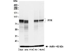Western Blotting (WB) image for anti-Interferon, gamma-Inducible Protein 16 (IFI16) (AA 350-400) antibody (ABIN7795822)