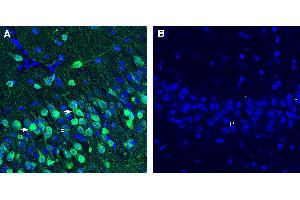 Expression of GPR173 in mouse hippocampusImmunohistochemical staining of perfusion-fixed frozen mouse brain sections with Anti-GPR173 Antibody (ABIN7581888), (1:200), followed by goat anti-rabbit-AlexaFluor-488.