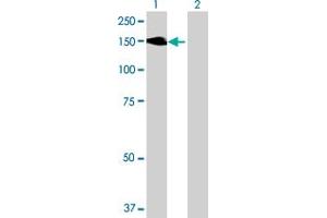 Western Blot analysis of MYLK expression in transfected 293T cell line ( H00004638-T01 ) by MYLK MaxPab polyclonal antibody. (MYLK 抗体  (AA 1-992))