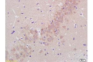 Formalin-fixed and paraffin embedded rat brain labeled with Rabbit Anti Aggrecanase-2/ADAMTS5 Polyclonal Antibody, Unconjugated (ABIN701005) at 1:200 followed by conjugation to the secondary antibody and DAB staining (ADAMTS5 抗体  (AA 511-610))