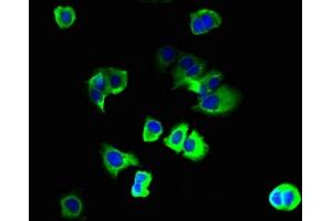 Immunofluorescent analysis of MCF-7 cells using ABIN7163816 at dilution of 1:100 and Alexa Fluor 488-congugated AffiniPure Goat Anti-Rabbit IgG(H+L) (PKD2L2 抗体  (AA 390-523))
