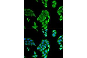Immunofluorescence analysis of U2OS cells using NOL3 antibody (ABIN6132415, ABIN6144704, ABIN6144706 and ABIN6221927). (NOL3 抗体  (AA 1-208))