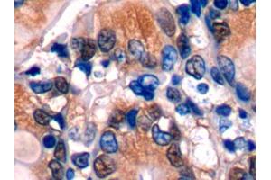 DAB staining on IHC-P; Samples: Mouse Colon Tissue (Glutathione Synthetase 抗体  (AA 270-474))