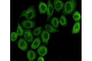 Immunocytochemistry staining of HeLa cells fixed with 4 % Paraformaldehyde and using anti-pyruvate dehydrogenase (lipoamide) alpha 1 mouse mAb(dilution 1:100). (PDHA1 抗体)
