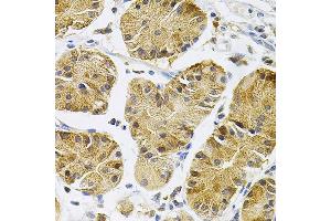 Immunohistochemistry (IHC) image for anti-Neurotrophic Tyrosine Kinase, Receptor, Type 1 (NTRK1) (C-Term) antibody (ABIN7268895)