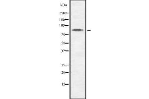 Western blot analysis of CDH10 using Jurkat whole cell lysates (CDH10 抗体  (C-Term))