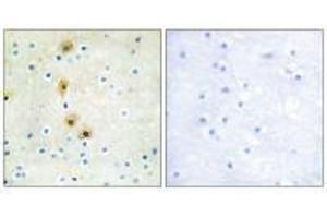 Immunohistochemistry (IHC) image for anti-V-Akt Murine Thymoma Viral Oncogene Homolog 1 (AKT1) (Tyr326) antibody (ABIN7179970)