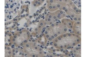 Detection of TGFb1 in Mouse Kidney Tissue using Polyclonal Antibody to Transforming Growth Factor Beta 1 (TGFb1) (TGFB1 抗体  (AA 279-390))