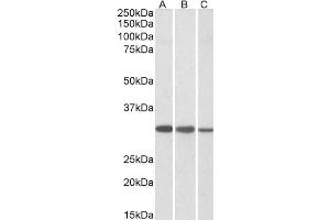 Western Blotting (WB) image for anti-Capping Protein (Actin Filament) Muscle Z-Line, beta (CAPZB) antibody (ABIN5907201) (CAPZB 抗体)