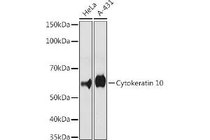 Western blot analysis of extracts of various cell lines, using Cytokeratin 10 antibody (ABIN1679404, ABIN3019133, ABIN3019134 and ABIN7101721) at 1:500 dilution. (Keratin 10 抗体)