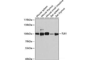 Western blot analysis of extracts of various cell lines using TLR1 Polyclonal Antibody at dilution of 1:1000. (TLR1 抗体)