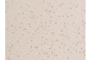 ABIN6267244 at 1/100 staining mouse brain tissue sections by IHC-P. (MITF 抗体  (pSer73, pSer180))