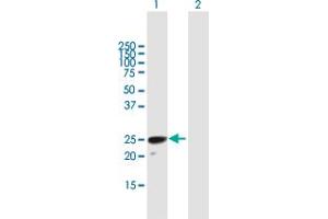 Western Blot analysis of H1FOO expression in transfected 293T cell line by H1FOO MaxPab polyclonal antibody. (H1FOO 抗体  (AA 1-207))
