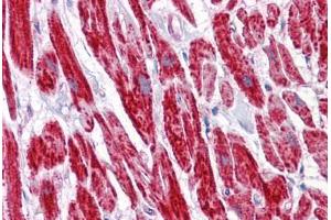 Human Heart: Formalin-Fixed, Paraffin-Embedded (FFPE) (COX6B1 抗体  (AA 1-87))