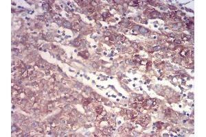 Immunohistochemistry (IHC) image for anti-Transthyretin (TTR) (AA 1-147) antibody (ABIN5875576) (TTR 抗体  (AA 1-147))