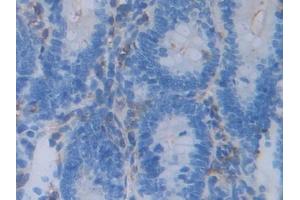 DAB staining on IHC-P; Samples: Rat Intestine Tissue (Acrosin 抗体  (AA 43-291))