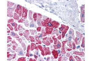 Immunohistochemistry (IHC) image for anti-Potassium Voltage-Gated Channel, Subfamily H (Eag-Related), Member 5 (KCNH5) (AA 156-205) antibody (ABIN6736405)