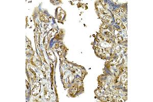 Immunohistochemistry of paraffin-embedded human placenta using IFIH1 Rabbit pAb (ABIN6131879, ABIN6142174, ABIN6142175 and ABIN6217724) at dilution of 1:50 (40x lens).