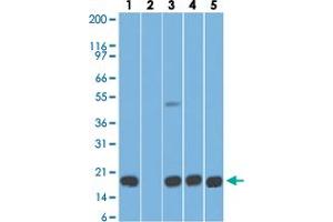 Western blot analysis of Lane 1: human stomach tissue lysate in the absence of immunizing peptide, Lane 2: human stomach tissue lysate in the presence of immunizing peptide, Lane 3: mouse stomach tissue lysate, Lane 4: rat stomach tissue lysate and Lane 5: HCT-116 cell lysate with AGR2 monoclonal antibody, clone IMG10E2  at 5 ug/mL working concentration. (AGR2 抗体  (AA 50-100))