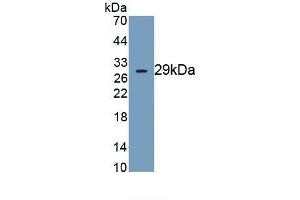 Detection of Recombinant DNAH11, Human using Monoclonal Antibody to Dynein, Axonemal, Heavy Chain 11 (DNAH11) (DNAH11 抗体  (AA 3896-4122))