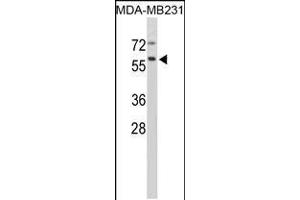Western blot analysis of in MDA-MB231 cell line lysates (35ug/lane) (Cathepsin F 抗体  (AA 261-290))