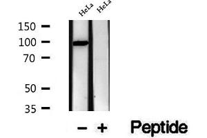 Western blot analysis of extracts of HeLa cells, using VPS16 antibody. (VPS16 抗体  (Internal Region))