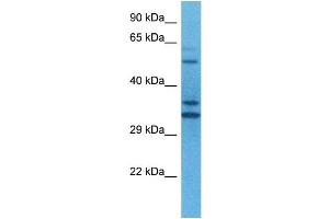 Host:  Rabbit  Target Name:  TEAD2  Sample Tissue:  Human U937 Whole Cell  Antibody Dilution:  1ug/ml (TEAD2 抗体  (N-Term))