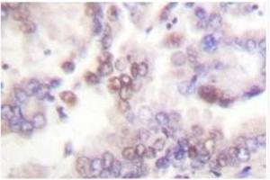 Image no. 1 for anti-Cyclin-Dependent Kinase Inhibitor 2B (p15, Inhibits CDK4) (CDKN2B) antibody (ABIN271760) (CDKN2B 抗体)