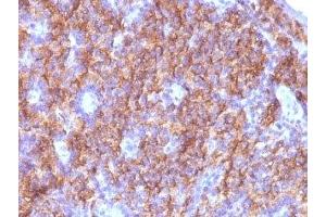 Formalin-fixed, paraffin-embedded parathyroid stained with Chromogranin A antibody (CGA/413 + CHGA/777 + CHGA/798)