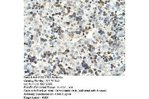 Rabbit Anti-HSD17B6 Antibody  Paraffin Embedded Tissue: Human Liver Cellular Data: Hemopoietic Antibody Concentration: 4. (HSD17B6 抗体  (N-Term))