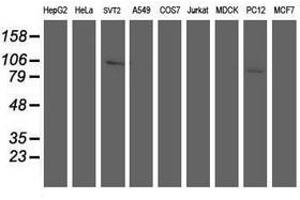 Image no. 4 for anti-Anaphase Promoting Complex Subunit 2 (ANAPC2) antibody (ABIN1496637)