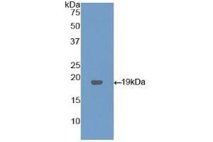 Detection of Recombinant LPCAT3, Human using Polyclonal Antibody to Lysophosphatidylcholine Acyltransferase 3 (LPCAT3) (LPCAT3 抗体  (AA 122-233))