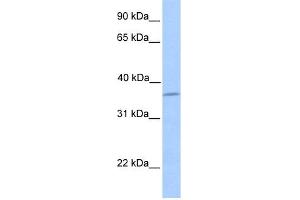 WB Suggested Anti-LAYN Antibody Titration: 0. (Layilin 抗体  (N-Term))