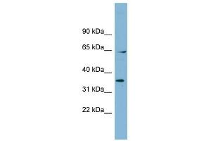 RanGAP1 antibody used at 1 ug/ml to detect target protein. (RANGAP1 抗体  (N-Term))
